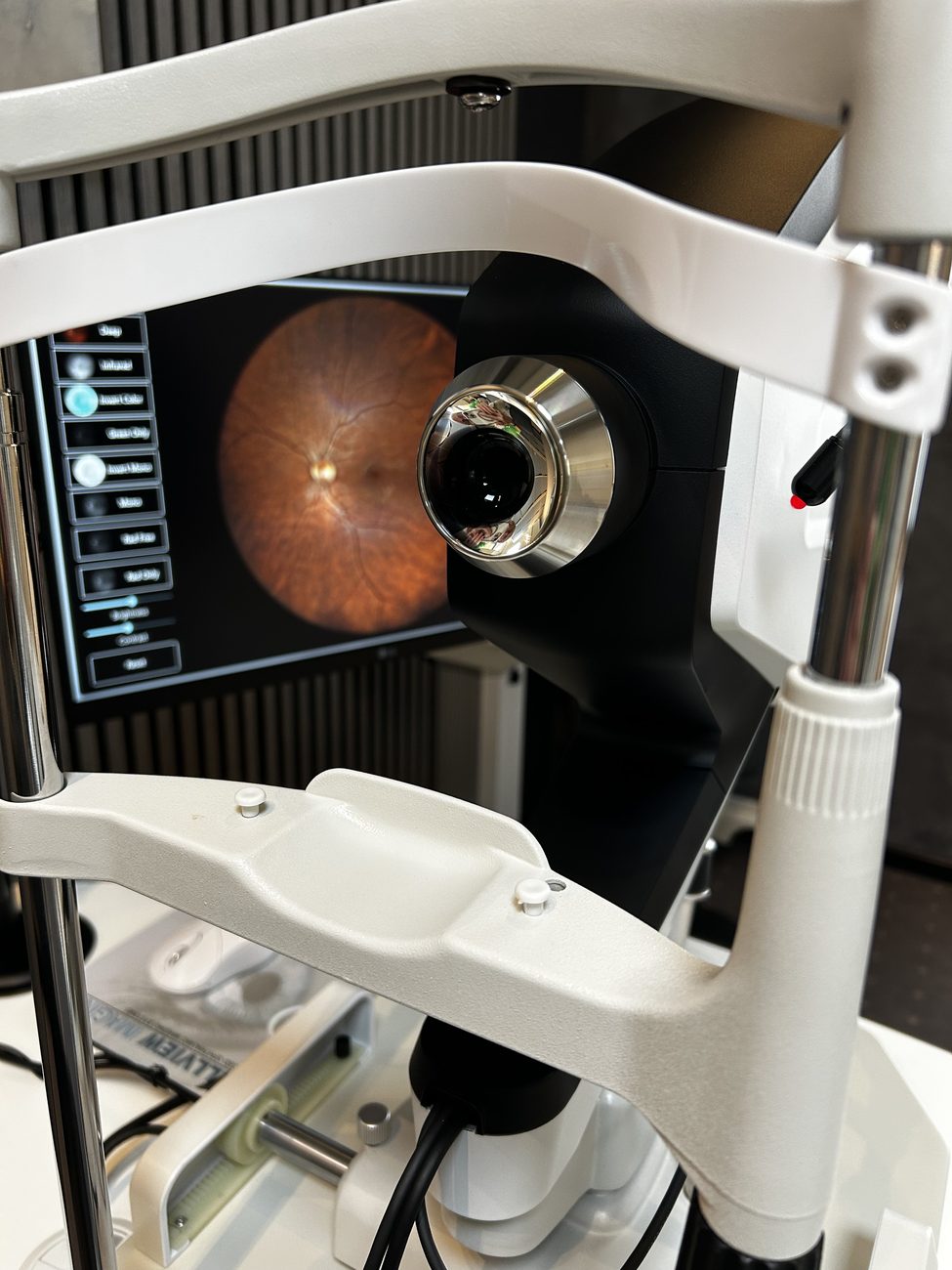 Augengesundheitscheck mit modernster Technologie